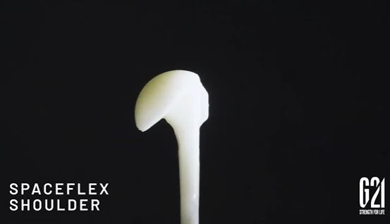 G21 SpaceFlex Shoulder: il distanziatore modulare per la revisione dell’artroplastica della spalla