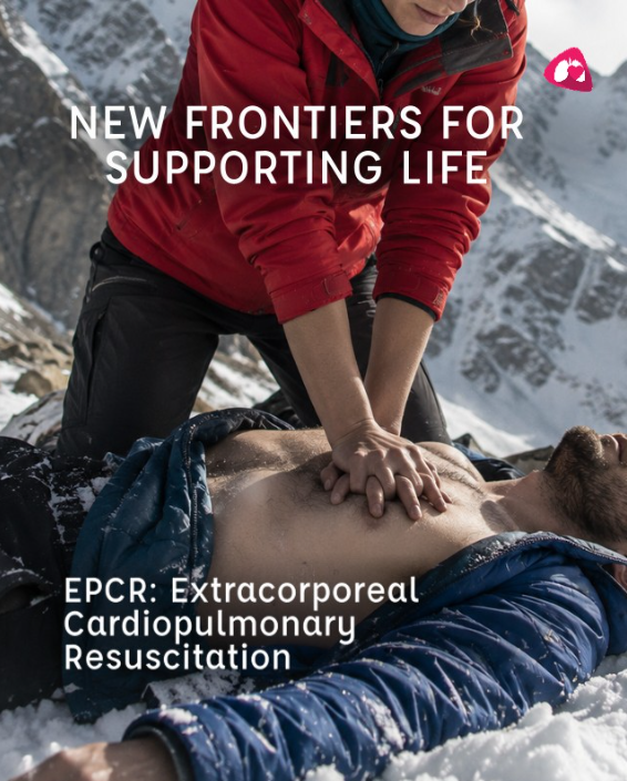 Eurosets: ECMO ed ECPR, nuove prospettive per il trattamento dell’arresto cardiaco refrattario