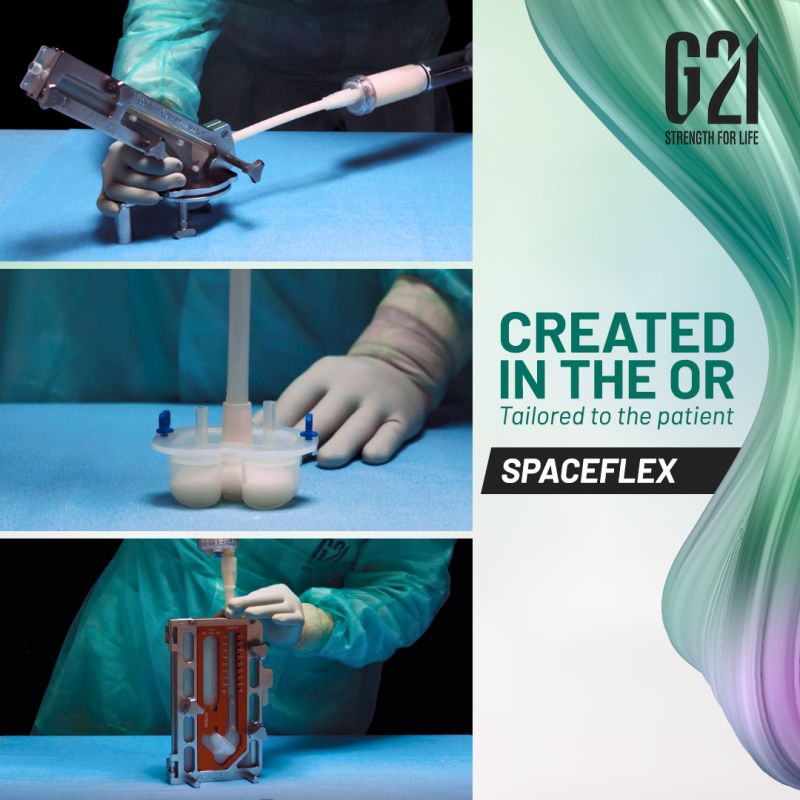 G21 presenta SpaceFlex™: distanziatori modulari personalizzabili per la gestione delle infezioni periprotesiche